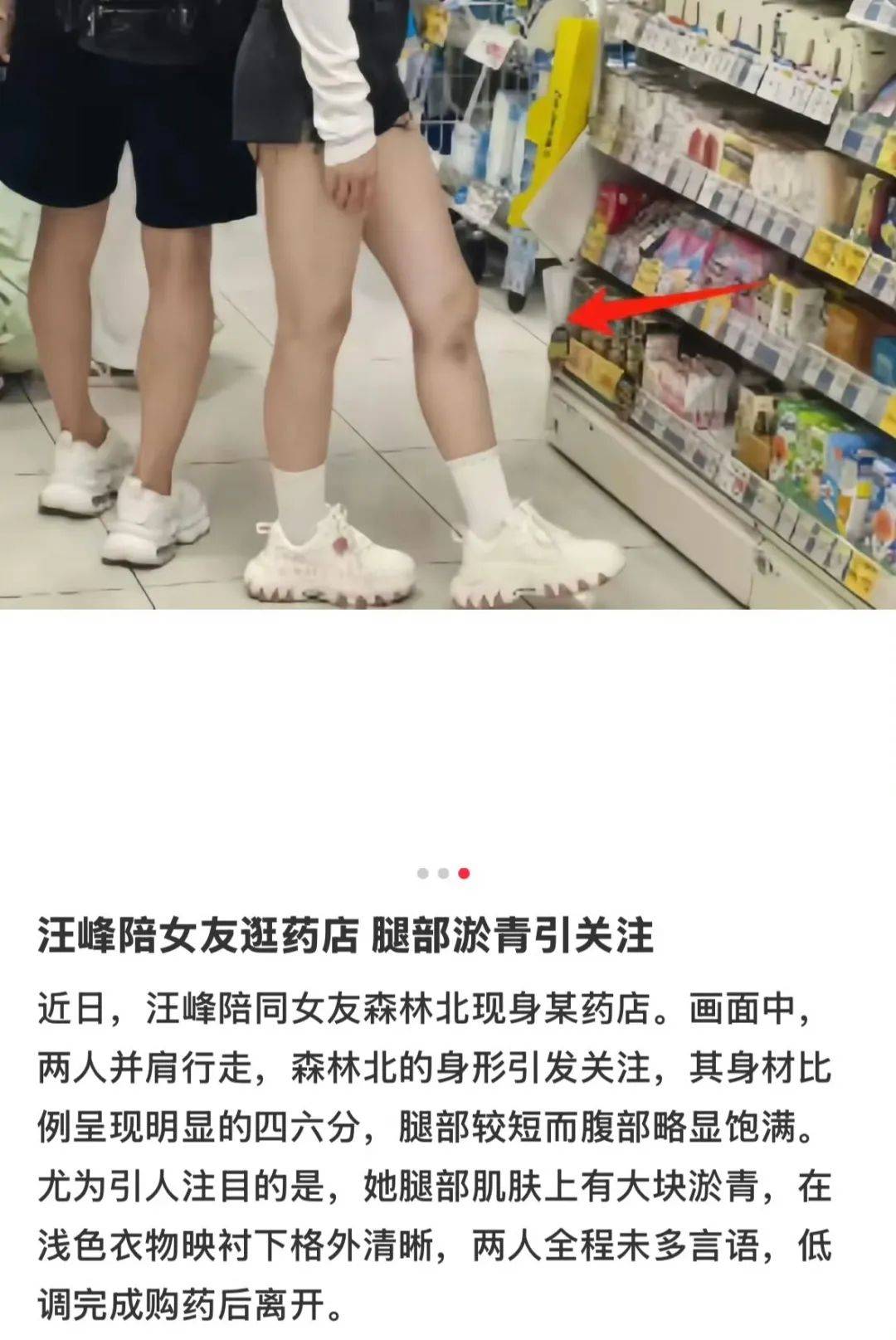 汪峰陪女友国外买药被拍，女方满腿淤青成全网亮点！