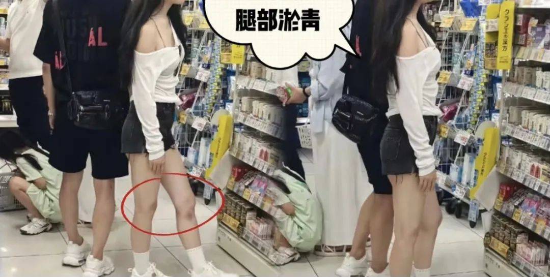 汪峰陪女友国外买药被拍，女方满腿淤青成全网亮点！